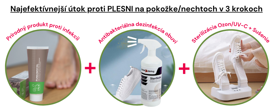 Plesne na pokožke a nechtoch